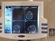 Neuronavegació optimitza la resecció de tumors i la col·locació d’implants