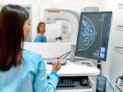 El 84% de dones amb càncer de mama precoç HR+/HER2- temen tornar a patir-lo
