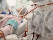 La malaltia renal crònica obliga més de 68.000 persones a tractament renal a Espanya